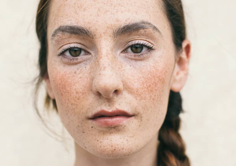 Луничките – естествени, весели и много модерни