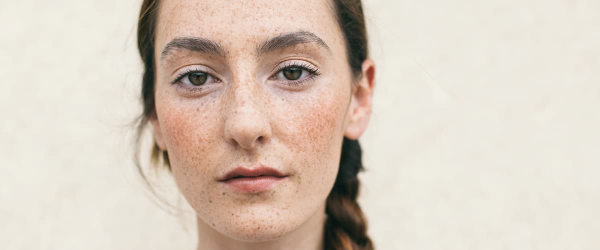 Луничките – естествени, весели и много модерни