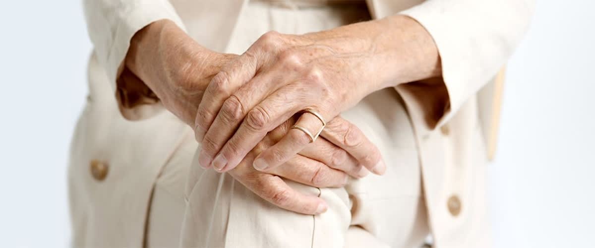 Пигментни петна