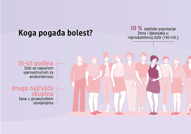 Endometrioza: uzroci, simptomi i liječenje - infografika