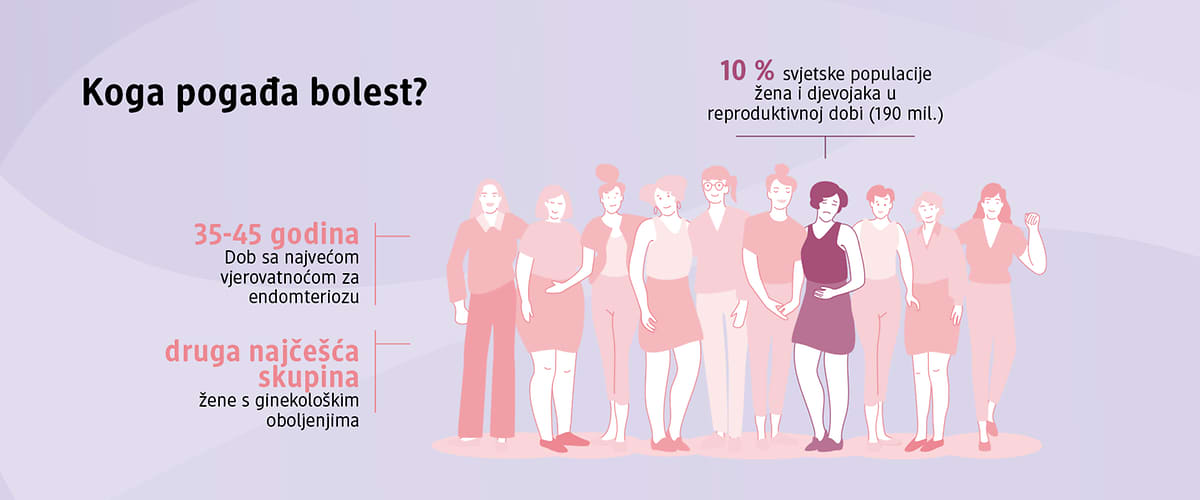 Endometrioza: uzroci, simptomi i liječenje - infografika