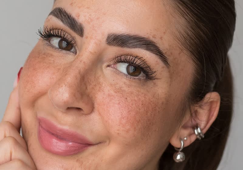 Frau mit vielen Sommersprossen im Gesicht