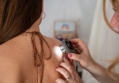 Dermatološki pregled