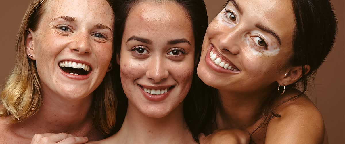 Tri djevojke različitih tipova kože