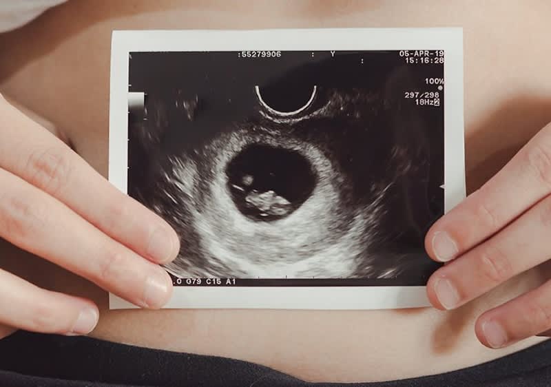 Jak oznámit těhotenství