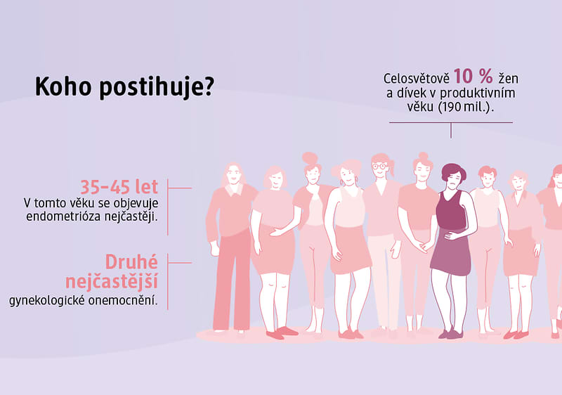 Endometrióza