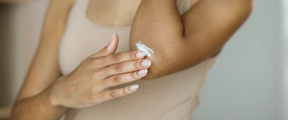 žena si natírá suchou kůži na loktech