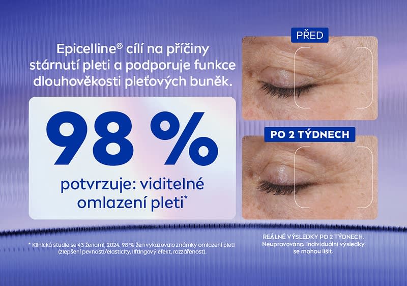 Epicelline cílí na príčiny stárnutí pleti a podporuje funkce dlouhověkosti pleťových buněk.