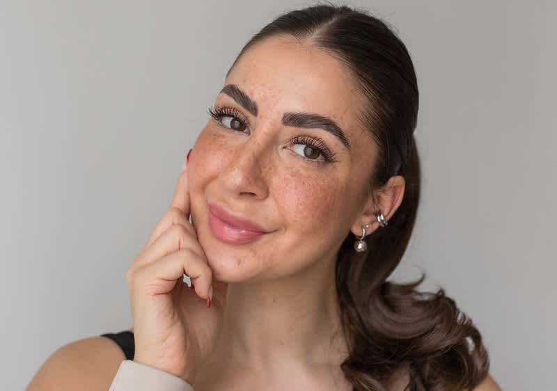 Frau mit vielen Sommersprossen im Gesicht