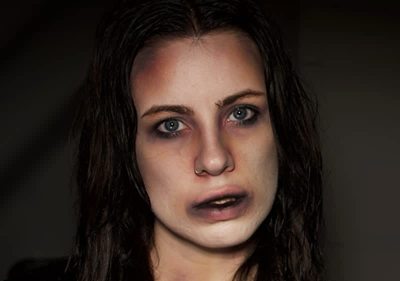 Porträt einer jungen Frau mit nassen, dunklen Haaren, blassem Teint und dunklen Augenringen, leicht geöffnetem Mund, kleinen blauen Blutergüssen rund um Augen und Stirn sowie einer kleinen Nasenpiercing-Ring, neutraler dunkler Hintergrund