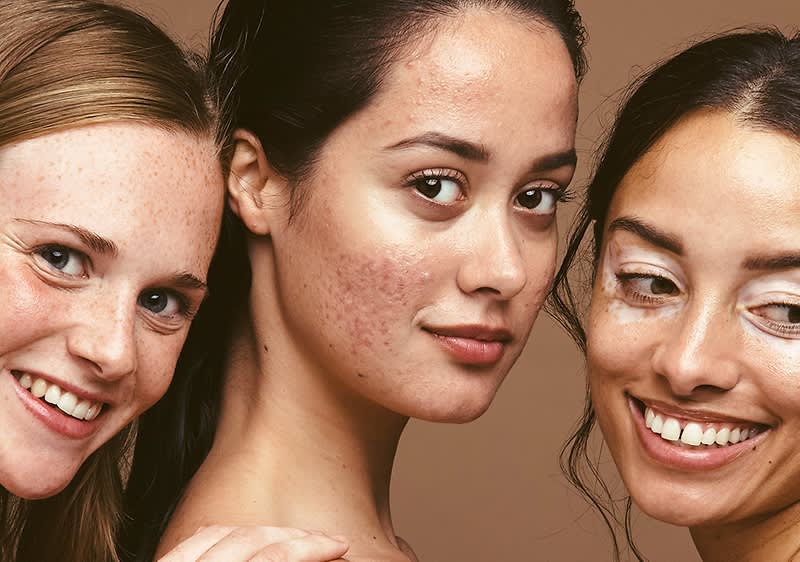 Drei Frauen mit verschiedenen Hauttypen