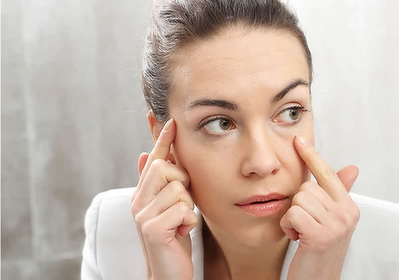 Junge Frau mit dunklen Augenringen