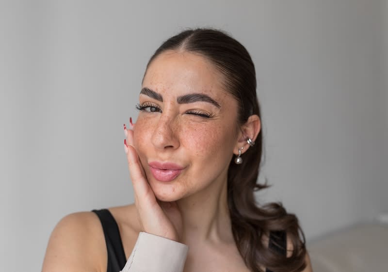 Frau mit vielen Sommersprossen im Gesicht