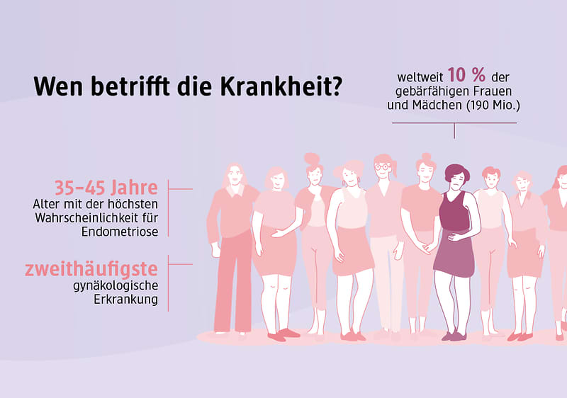 Endometriose betrifft weltweit 10% der Frauen im gebärfähigen Alter Textgrafik