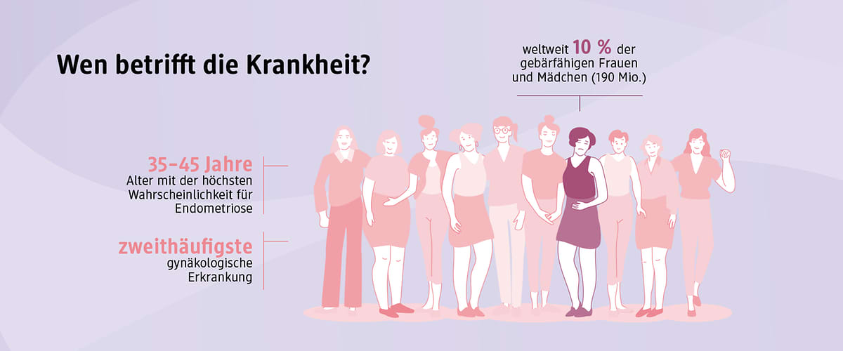 Endometriose betrifft weltweit 10% der Frauen im gebärfähigen Alter Textgrafik