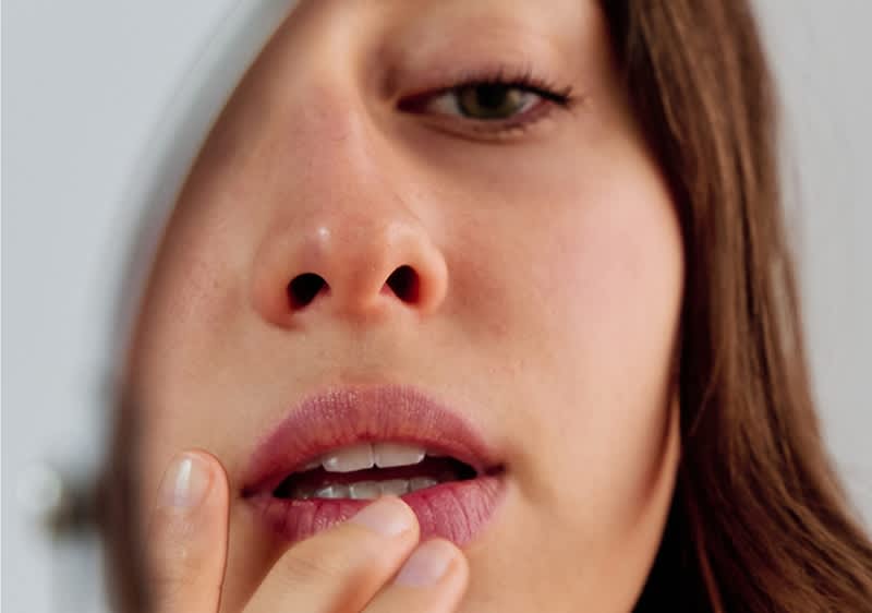 Frau mit Aphten im Mund