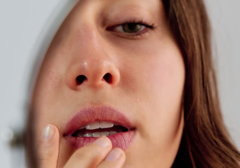 Frau mit Aphten im Mund