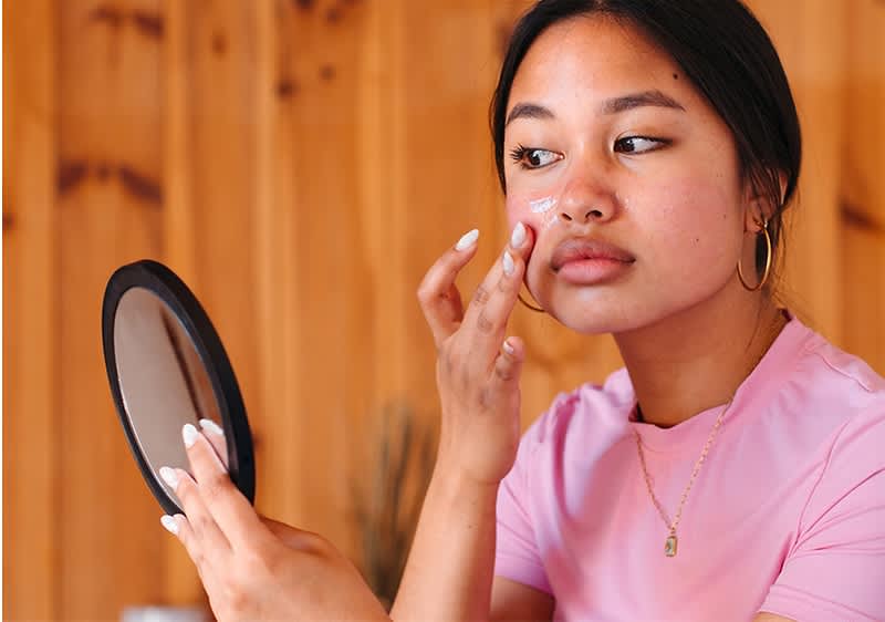 Mädchen mit unreiner Haut beim EIncremen