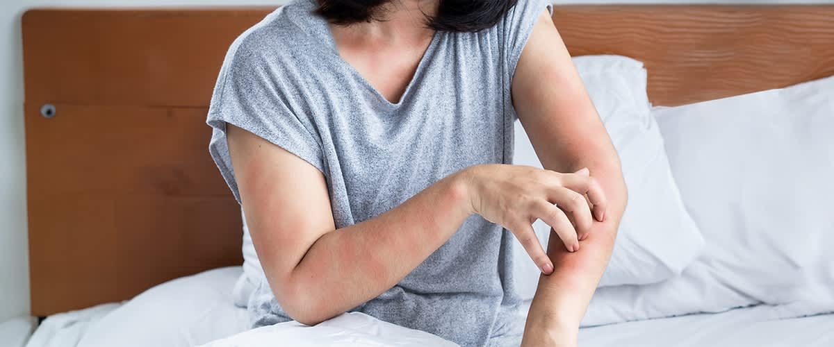 Frau kratzt sich am Arm im Bett