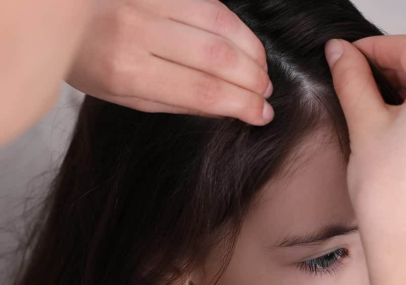 Mutter untersucht dunkle Haare von Tochter nach Laeusen