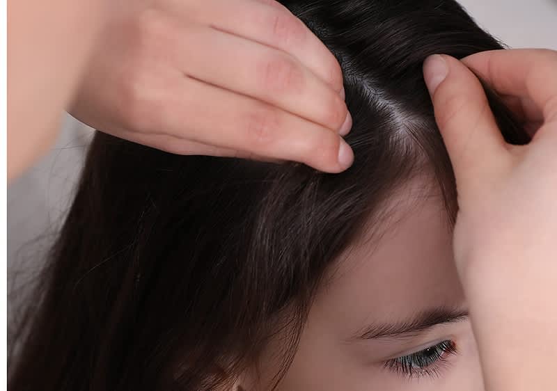 Mutter untersucht dunkle Haare von Tochter nach Laeusen