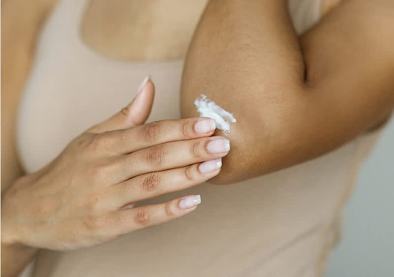 Frau pflegt ihren Ellenbogen