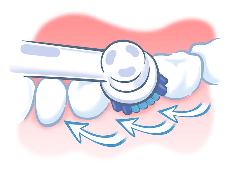 KAI Methode Außenflächen