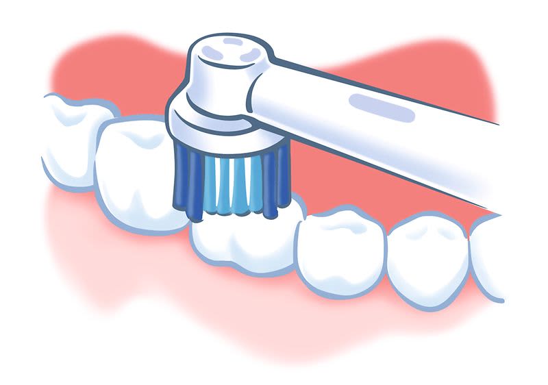 KAI Methode Kauflächen