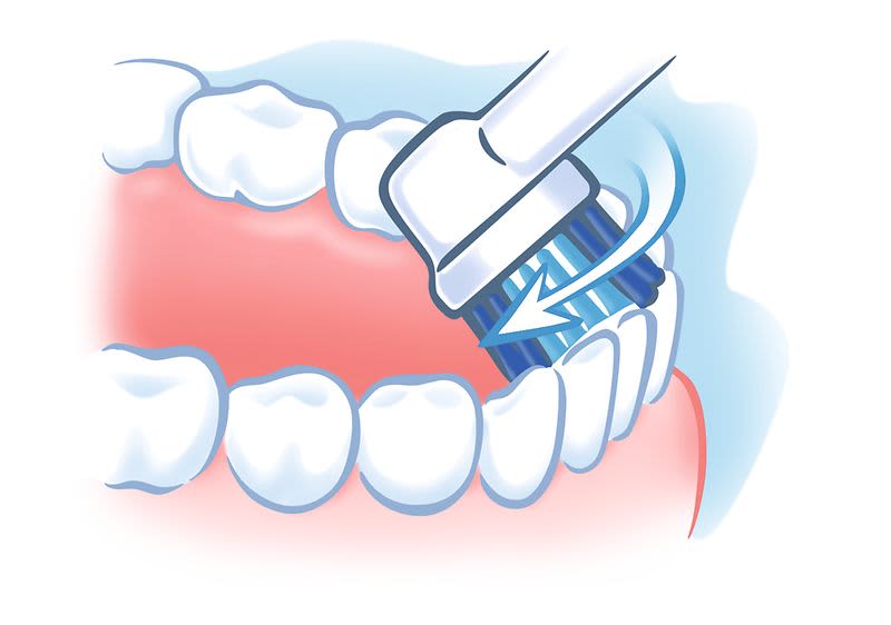 KAI Methode Innenflächen