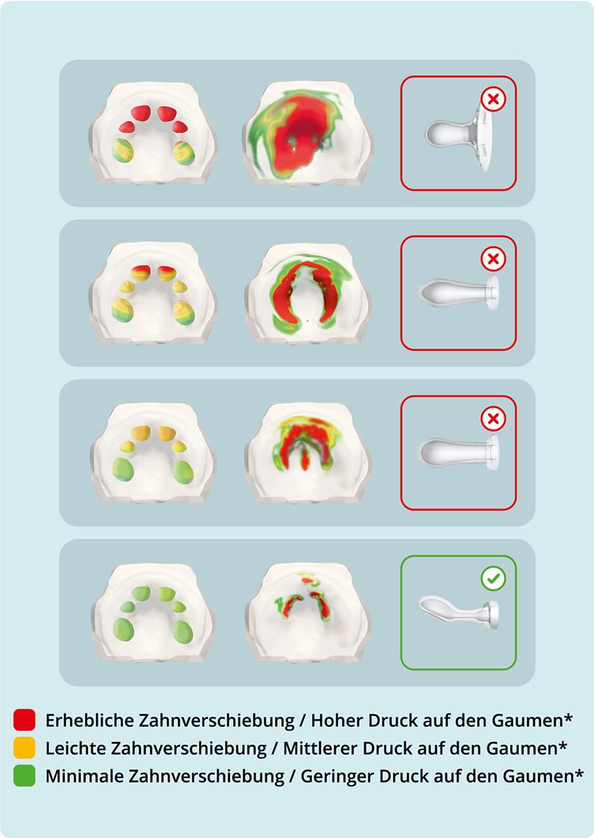 Illustration von 4 Gaumen, die den Druck auf den Gaumen durch verschiedene Schnullerformen zeigen; die oberen 3 Gaumen haben recht große rote und grüne Bereiche, die auf hohen Druck und leichte bis erhebliche Zahnverschiebung hinweisen, neben ihnen ein Schnuller mit einem roten X, der untere Gaumen hat überwiegend grüne Bereiche, was auf weniger Druck und minimale Zahnverschiebung hinweist, daneben ein Schnuller mit einem grünen Häkchen