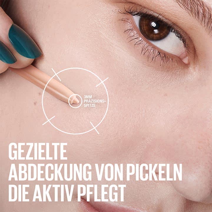 Nahaufnahme einer Hand mit türkis lackierten Fingern, die einen beigen Concealer-Stift mit sichtbarer 3-mm-Präzisionsspitze nahe einem Pickel am Wangenbereich hält; großer weißer Text: „Gezielte Abdeckung von Pickeln die aktiv pflegt“