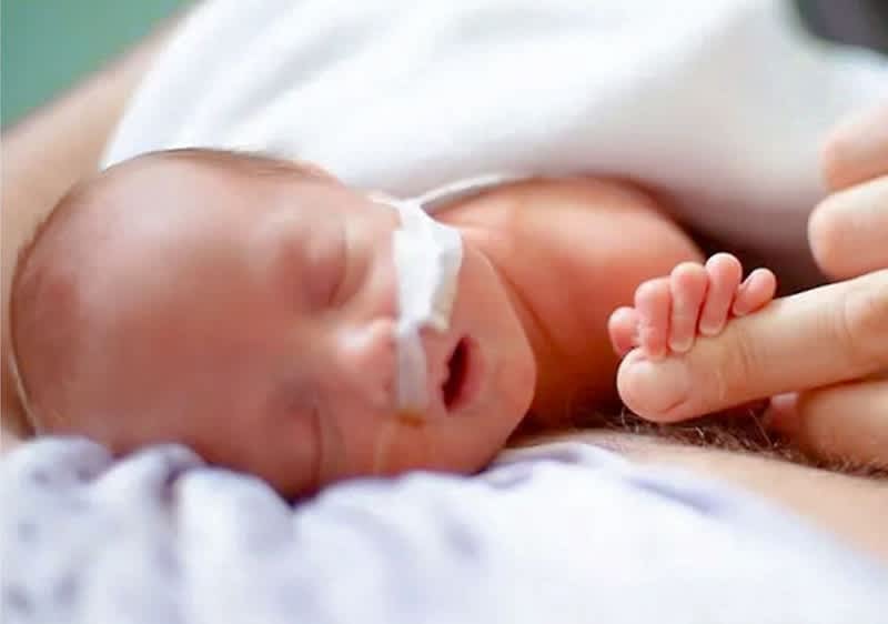 Neugeborenes mit Nasensonde liegt schlafend auf einer Decke, eine Hand hält vorsichtig einen kleinen Fuß