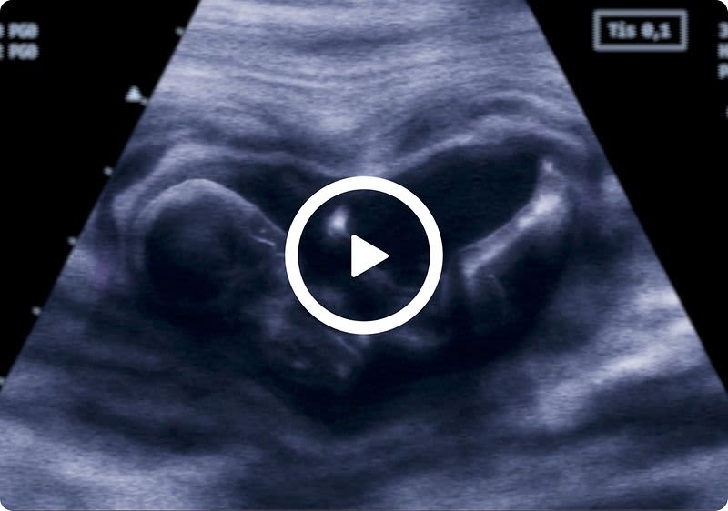 Vorfreude ab dem ersten Moment: mit Bübchens Pflegeprodukten