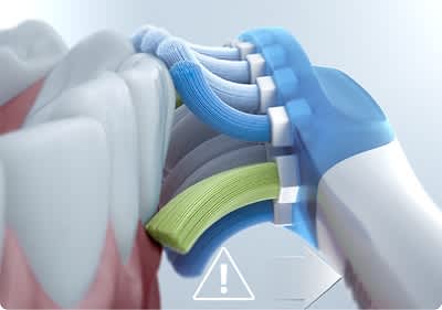 Zu fest gedrückt? Die Philips Sonicare macht Dich darauf aufmerksam.