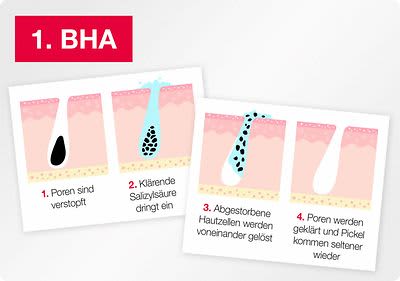 Die in den Neutrogena® Anti-Pickel+ Produkten enthaltene Beta-Hydroxy-Säure klärt Talg, der in den Poren eingeschlossenen ist.