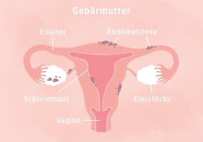 Gebärmutter Schaubild