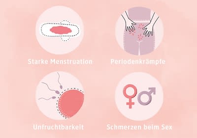 Starke Menstruation, Periodenkrämpfe, Unfruchtbarkeit, Schmerzen beim Sex