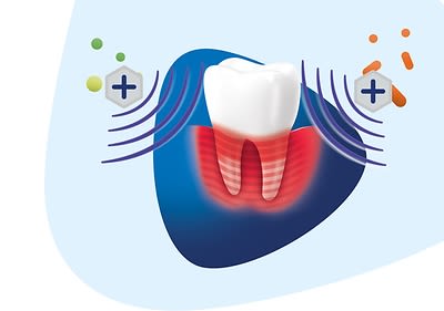 Die Parodont Expert Zahnpasta enthält eine zweifache Wirkformel mit einem Wirkungsverstärker.