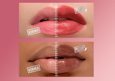 Vorher-nachher-Bild von Lifter Plump