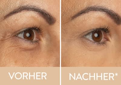 Magic Wonder Balm Bild 2 Eye