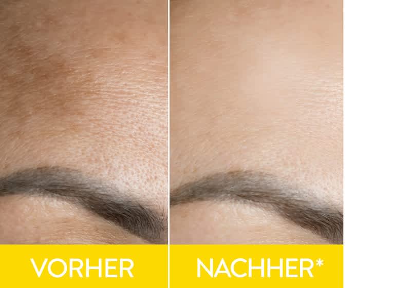 Vitamin C+ Vorher Nachher Bild 1