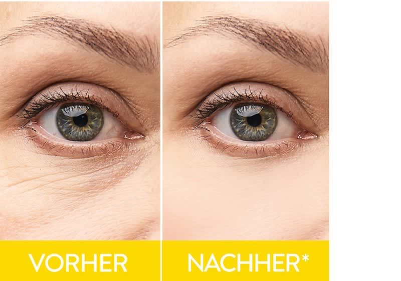 Vitamin C+ Vorher Nachher Bild2