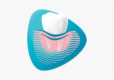 Grafik eines Zahns mit Zahnfleisch