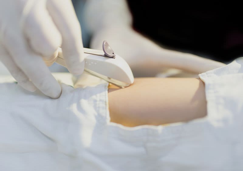 Hormonstäbchen als Verhütungsmittel