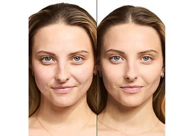 Blur It Out Anwendung Vorher Nachher