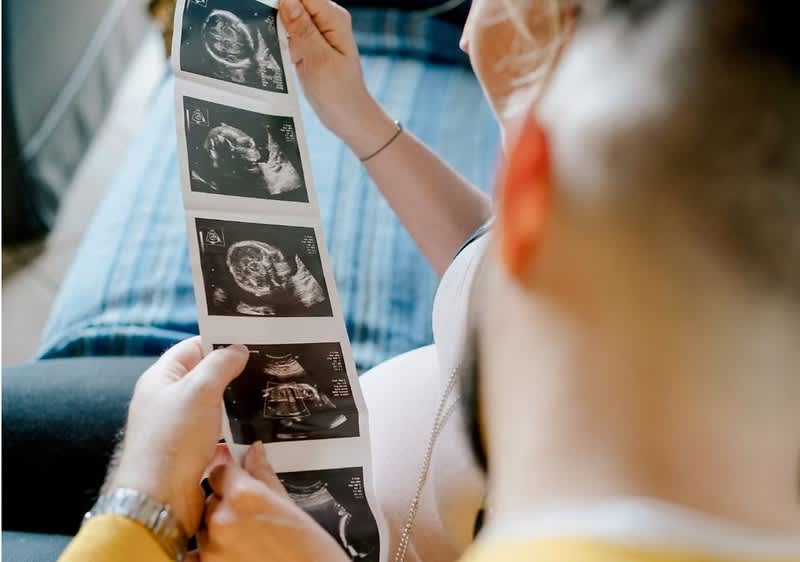 Zwei Personen halten gemeinsam eine senkrecht gehaltene Reihe von Ultraschallbildern, eine Person mit sichtbarem Babybauch sitzt im Hintergrund