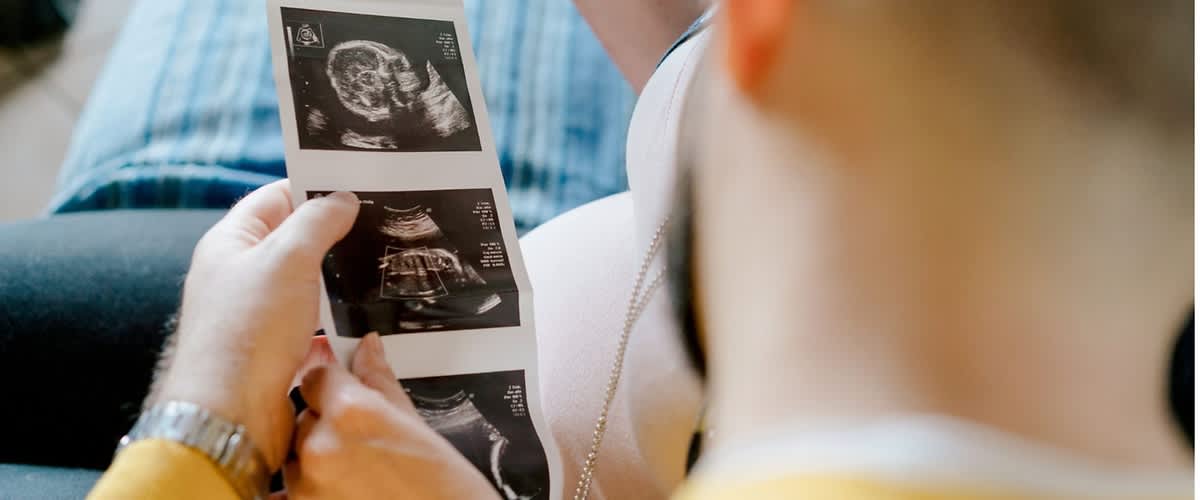 Zwei Personen halten gemeinsam eine senkrecht gehaltene Reihe von Ultraschallbildern, eine Person mit sichtbarem Babybauch sitzt im Hintergrund