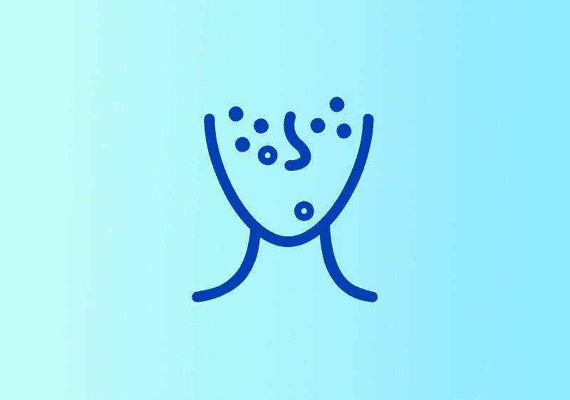 Eine Illustration zeigt ein stilisiertes Gesicht mit blauen Linien und Punkten auf hellblauem Hintergrund