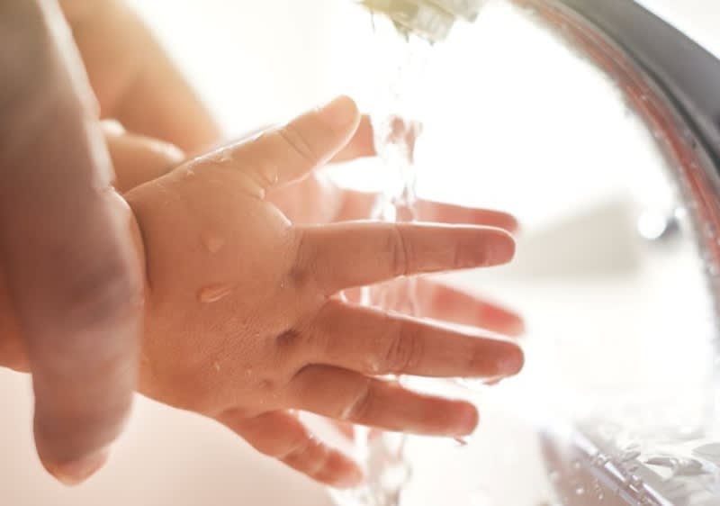 Hände werden unter Wasserhahn gehalten um Brandwunden zu kühlen