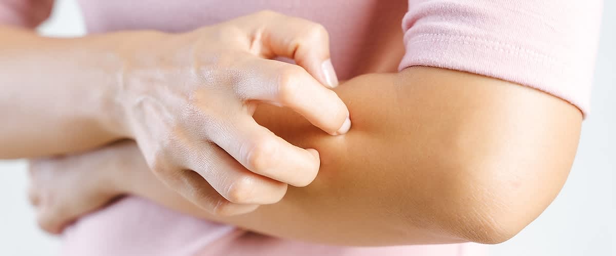 Eine Person kratzt mit der rechten Hand ihren linken Unterarm